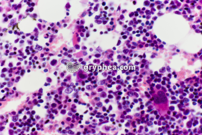 Moëlle osseuse in situ x200 - gryphea.org